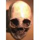 Human Skull, Homo sapiens, Peruvian with Cranial Binding